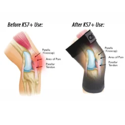 OS1st KS7+ Adjustable Performance Knee Sleeve -Pickleball Store OSF118 4 27552.1663784835