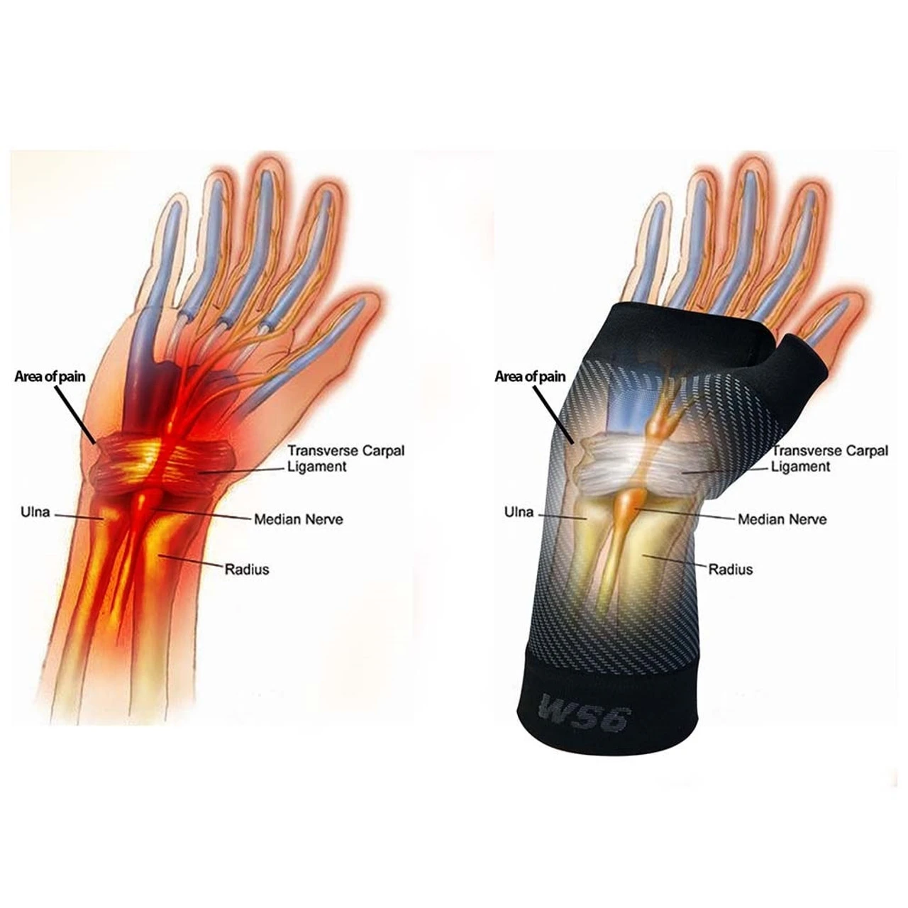 OS1st WS6 Performance Wrist Sleeve 3 OS1st WS6 Performance Wrist Sleeve - Image 3